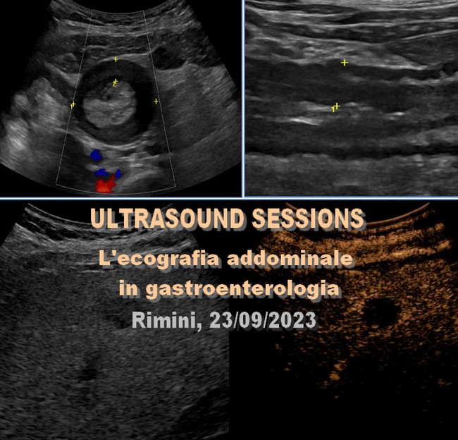 ULTRASOUND SESSIONS – L’ecografia addominale in gastroenterologia, Rimini 23/09/2023